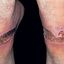24. Контактный дерматит на ногах фото